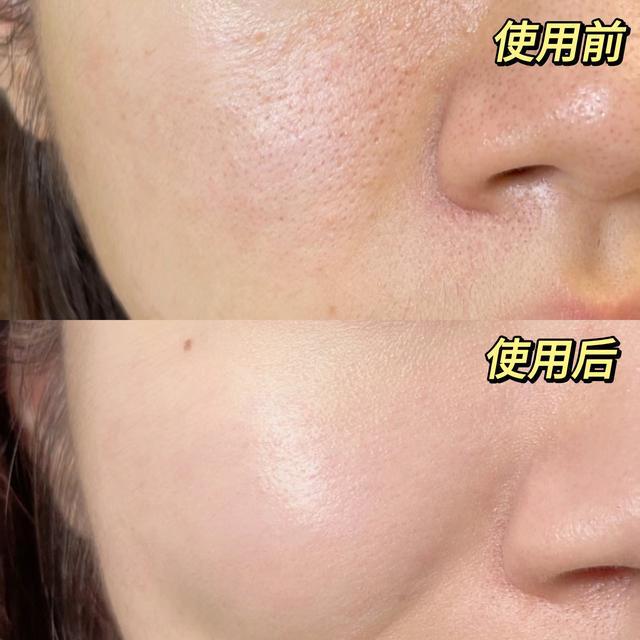 肤小吊瓶水光帮你告别无效补水OG真人游戏秋冬季护肤攻略肌(图1)