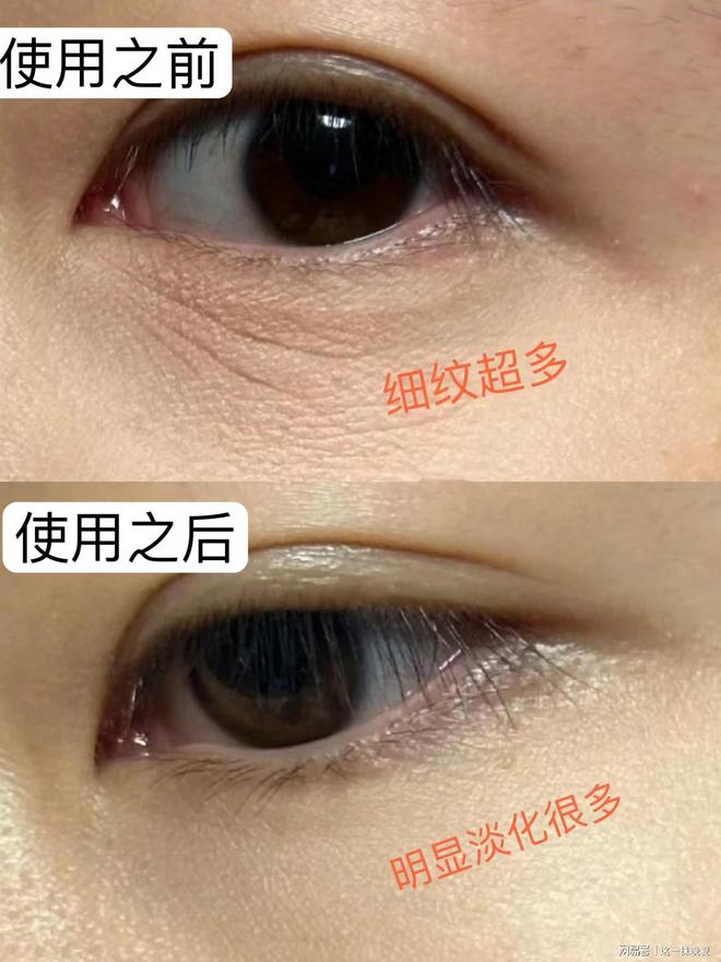 ？哪款眼霜更好用？这五款告诉你答案OG网站抗皱眼霜哪个牌子的效果好(图2)
