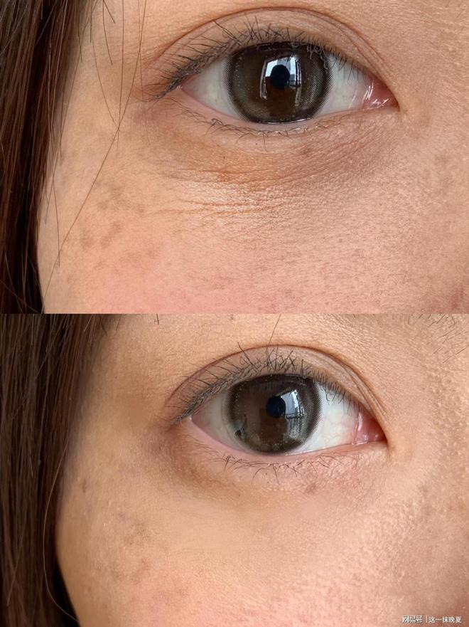 眼部肌肤衰老快来看看哪款眼霜最好用OG真人抗老眼霜哪个牌子好？延缓(图4)