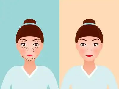 目比较好？几天见效术后案例医院OG网站想要眼部提升做什么项(图2)