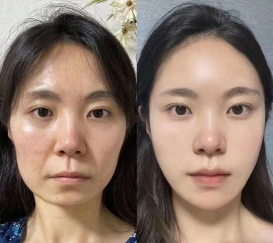 推荐专业抗皱绽放自信笑容OG真人平台抗皱护肤品(图1)