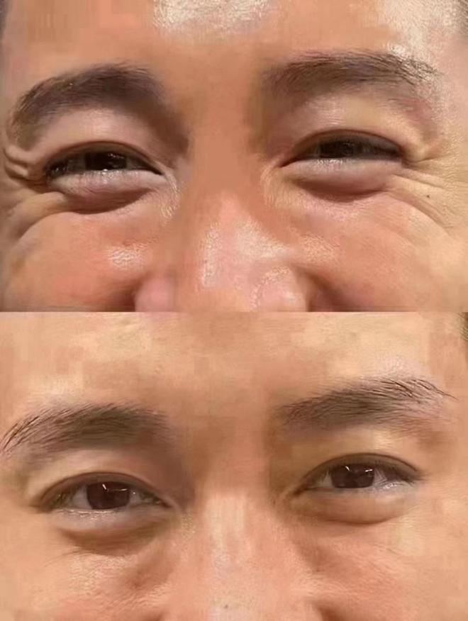 推荐专业抗皱绽放自信笑容OG真人平台抗皱护肤品(图6)